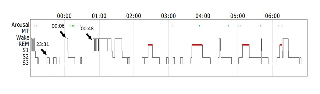 Balian et al Figure 1