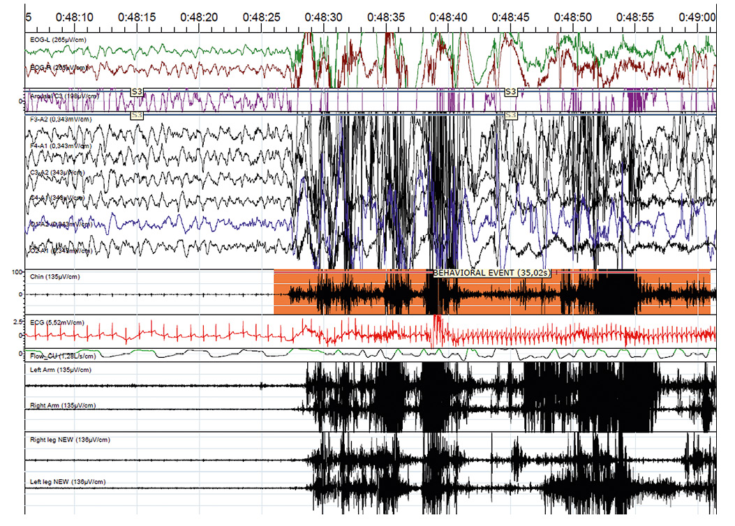 Balian et al Figure 2