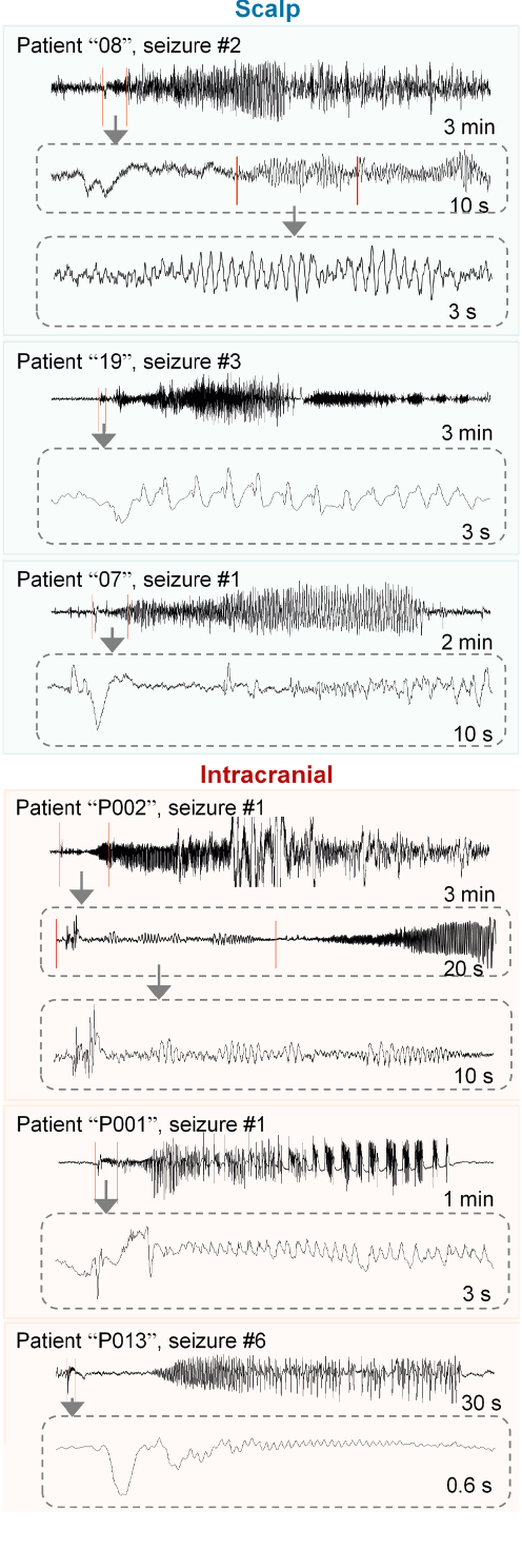 Fig 4