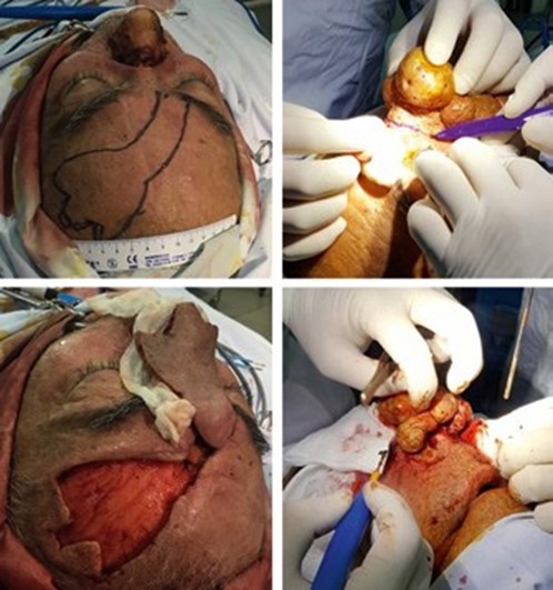 Non standard clinical situation in rhinosurgery 2