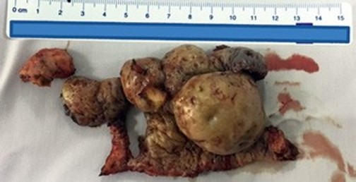 Non standard clinical situation in rhinosurgery 3